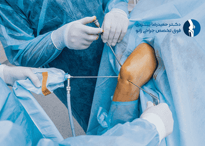 مزایای استفاده از آرتروسکوپی