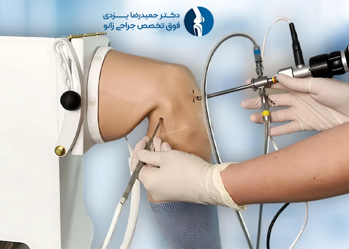 کاربرد آرتروسکوپی