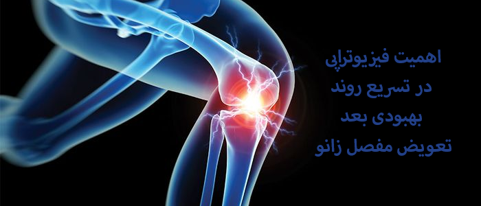 اهمیت فیزیوتراپی در تسریع روند بهبودی بعد تعویض مفصل زانو