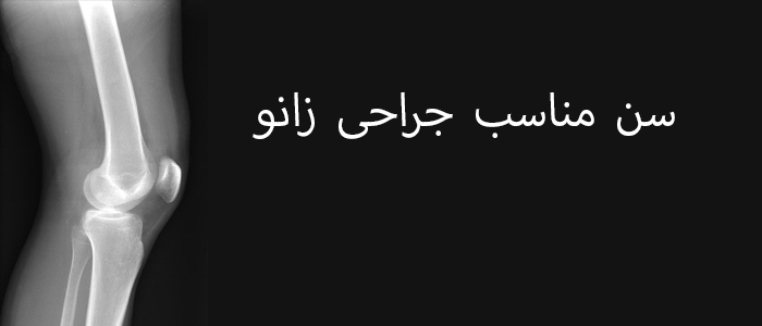 سن مناسب جراحی زانو