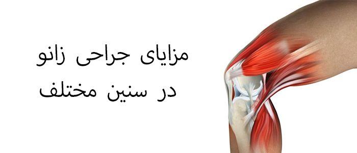 مزایای جراحی زانو در سنین مختلف