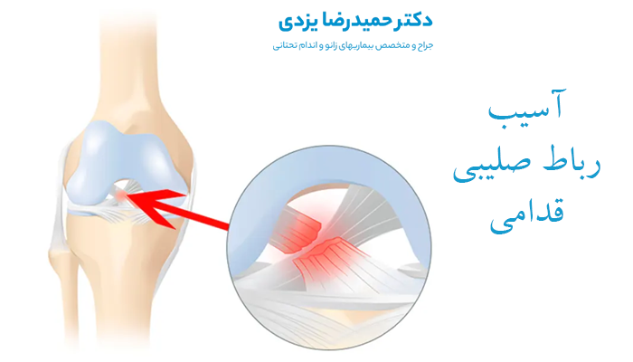 جراح آسیب رباط صلیبی قدامی
