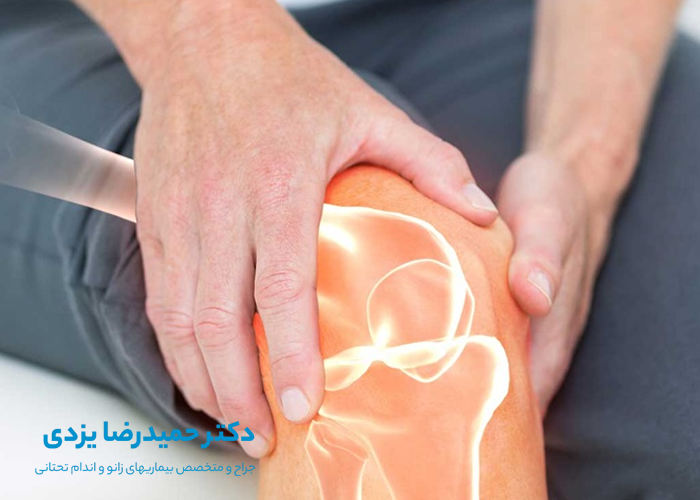 صدا نگران کننده زانو