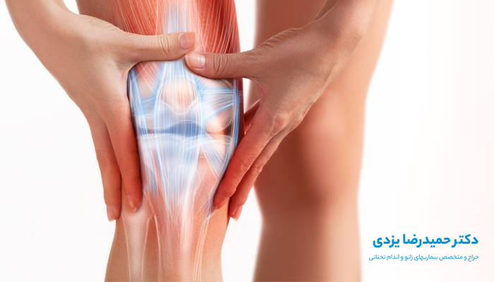 علائم پارگی رباط زانو