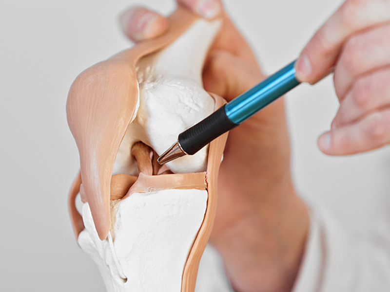 دوران نقاهت عمل مینیسک زانو