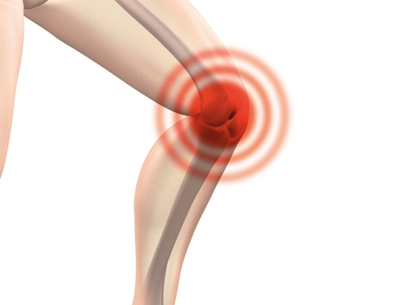 علت ورم زانو بعد از عمل مینیسک