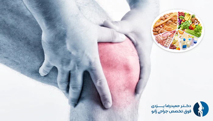 نقش تغذیه در کاهش ورم زانو بعد از جراحی مینیسک