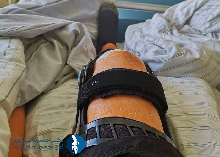 خواب تاثیر خواب در روند بهبودی بعد تعویض نفصل زانو