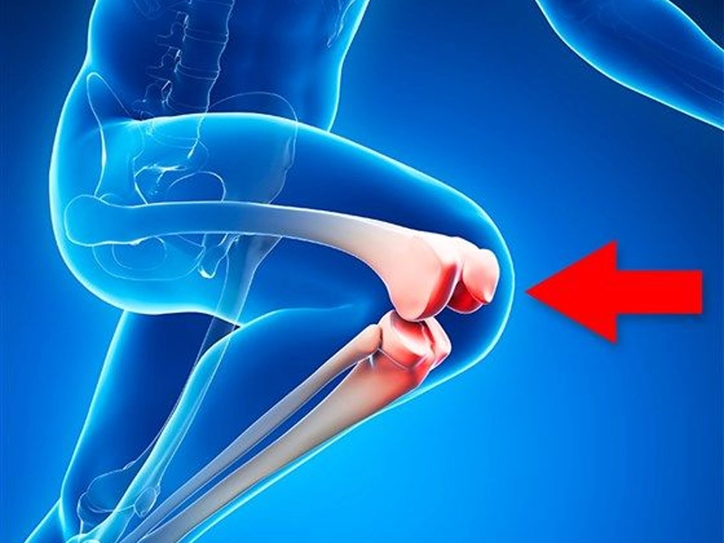 طول عمر تعویض مفصل زانو