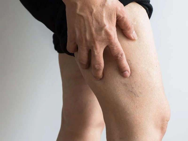 لخته شدن خون بعد از تعویض مفصل