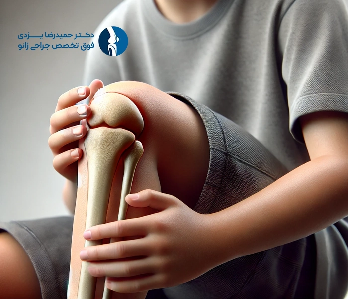 دلایل نرمی کشکک زانو یا کندرومالاسی پاتلا