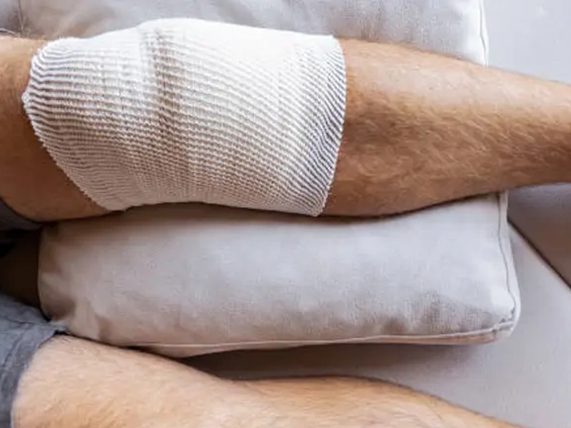 دوره نقاهت آرتروسکوپی زانو