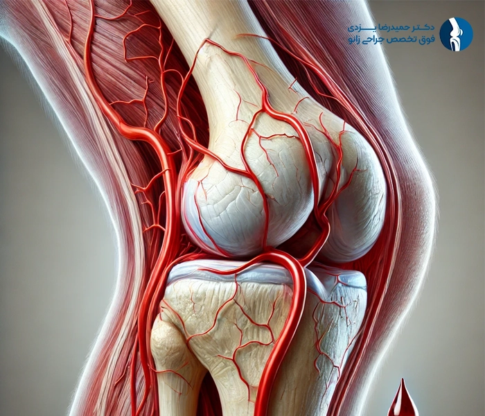 لخته شدن خون در زانو بعد عمل تعوبض مفصل