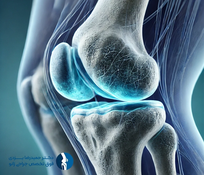 نرمی کشکک زانو