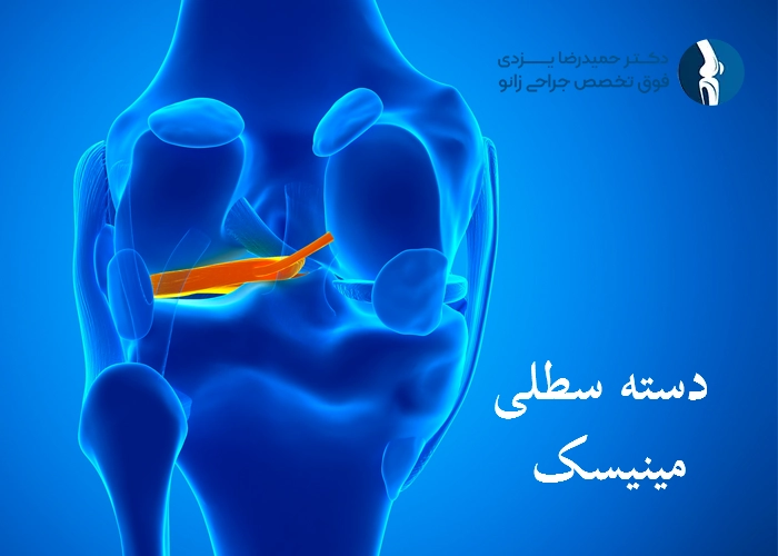 دسته سطلی مینیسک