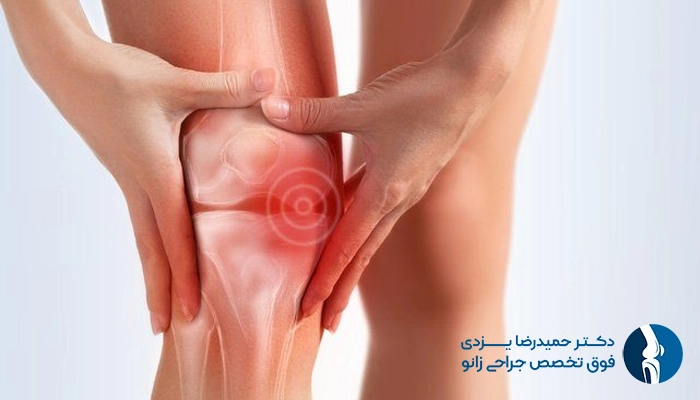 آب آوردن زانو