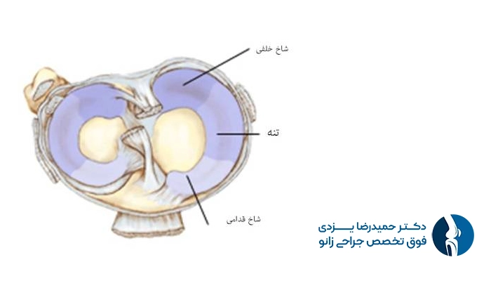 شاخ خلفی مینیسک زانو