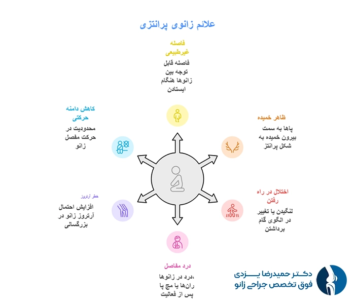 علائم زانوی پرانتزی چیست؟