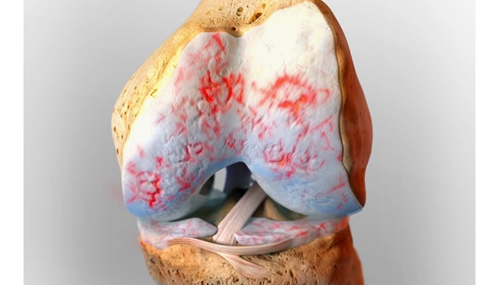 عفونت زانو چیست