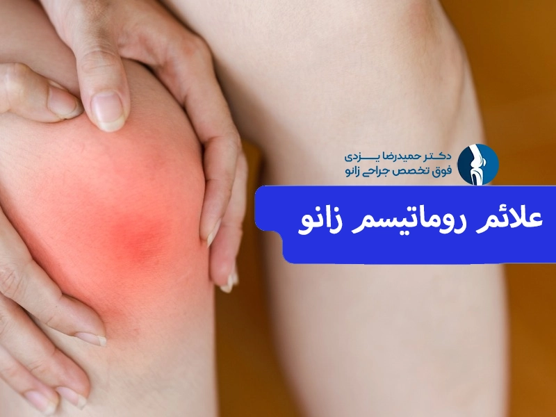 علائم روماتیسم زانو