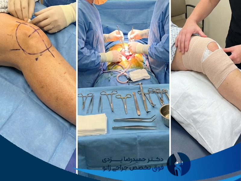 مراحل جراحی تعویض مفصل زانو